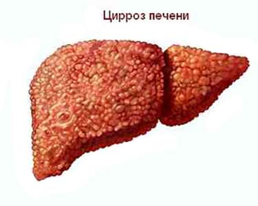 Хронический гепатит в средняя продолжительность жизни